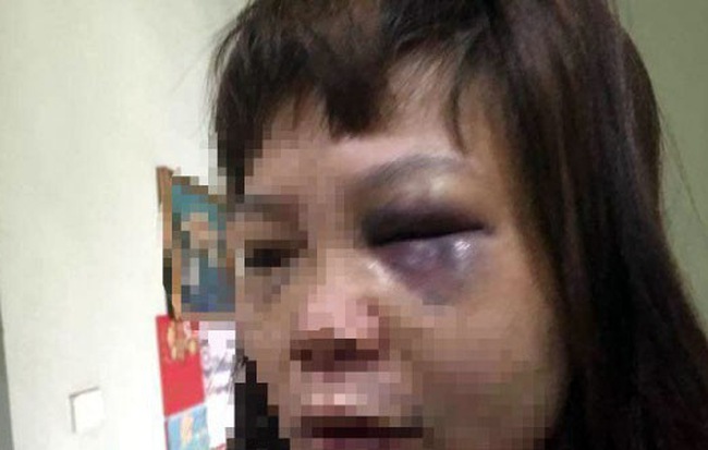 Khởi tố người chồng ở Quảng Ninh đưa vợ lên đồi đánh đập, cắt cẳng chân