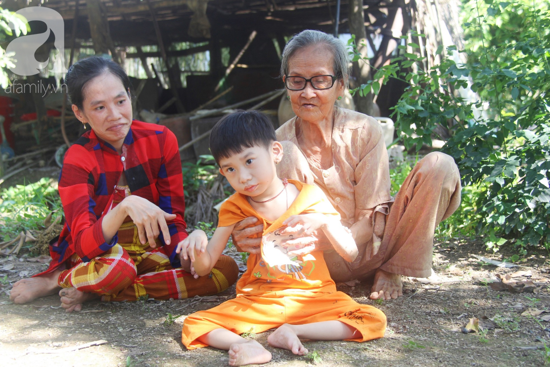 Bố bỏ từ khi chưa sinh ra, bé gái 5 tuổi bại não sống cùng người mẹ tật nguyền cầu xin một lần được chữa bệnh