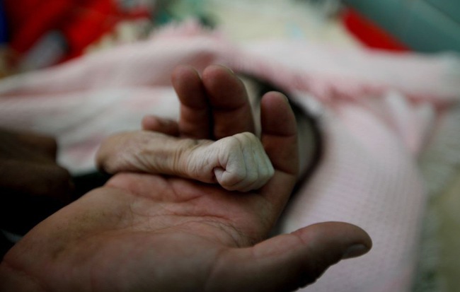 24h qua ảnh: Bà mẹ nắm tay con gái nhỏ tử vong do suy sinh dưỡng