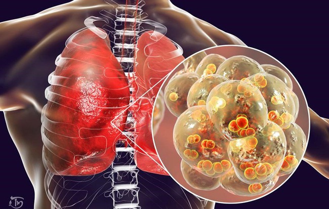 2 cách đơn giản của Đông y để chăm sóc phổi hiệu quả: Ai làm được phổi sẽ khỏe và ít bệnh