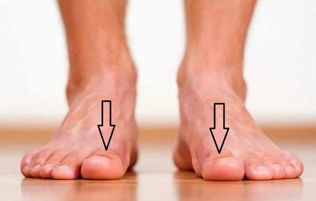Bàn chân xuất hiện cùng lúc 3 dấu hiệu này: Hãy cảnh giác vì có thể thận đang có bệnh
