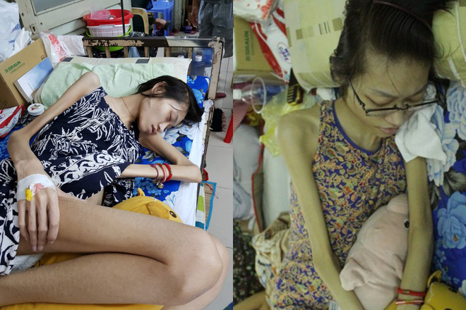 Người mẫu trẻ Kim Anh qua đời ở tuổi 26, sau 3 năm chống chọi với căn bệnh ung thư buồng trứng