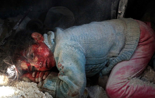 24h qua ảnh: Em bé Syria bị thương chờ được giải cứu