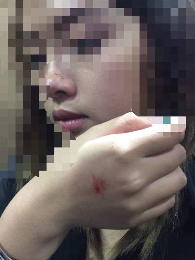 Cô gái bị ép hôn trong thang máy chung cư ở Hà Nội: "Anh ta không hề có thái độ hối lỗi"