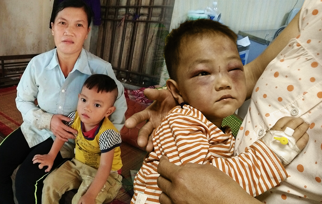 Hơn một năm, cuộc sống của bé trai 4 tuổi mồ côi, bị cha dượng đánh đập dã man khi đến thăm mẹ giờ ra sao?