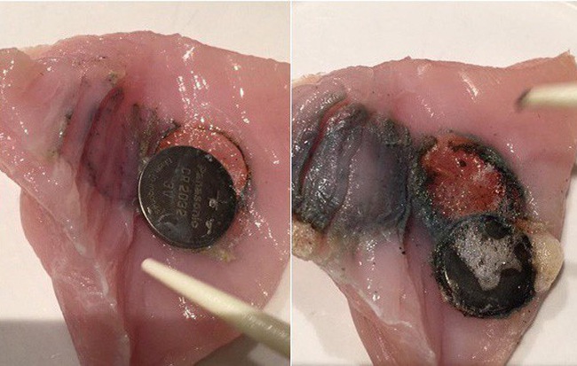 Sự thật mọi cha mẹ nên biết: Hình ảnh ghi lại điều đáng sợ sẽ xảy ra nếu trẻ nuốt phải pin