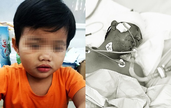 Cha bị tai nạn nguy kịch, bé trai 3 tuổi chỉ nhớ tên, ngồi khóc nức nở trong bệnh viện tìm người thân