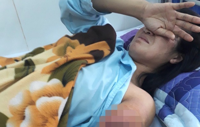 Cô giáo ở Gia Lai vượt 130km đi dạy học, bị tai nạn phải cắt bỏ cánh tay được chuyển về dạy ở gần nhà
