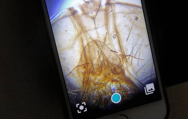 Phụ kiện độc đáo biến smartphone thành kính hiển vi, quan sát được cả vi khuẩn siêu nhỏ nhờ khả năng phóng đại gấp 1000 lần