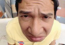 Chuyện NSƯT Quang Thắng bị bắt nạt, đánh đập chỉ vì mũi to