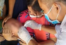 Thời điểm này cần cảnh giác bệnh bạch hầu: Cũng lây qua đường hô hấp giống Covid-19 nhưng gây tử vong cực nhanh, dấu hiệu rất dễ nhầm với bệnh vặt