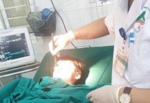 Lào Cai: Quạt trần rơi trúng đầu, một học sinh tiểu học phải nhập viện