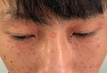 Hà Tĩnh: Laptop đang sạc pin phát nổ, 3 học sinh nhập viện