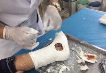 Cánh cổng sắt trường tiểu học đổ sập đè lên chân 1 học sinh lớp 3 ở Nghệ An