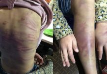 Khởi tố 2 đối tượng trong vụ bé gái 12 tuổi nghi bị bạo hành và xâm hại tình dục ở Hà Đông